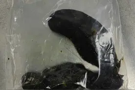 11岁女孩患上异食癖，爱吃头发快把自己拔秃了！医生提醒图片