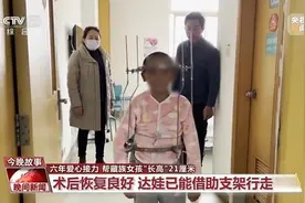 6年爱心接力 严重脊柱侧弯的藏族女孩“长高”21厘米图片