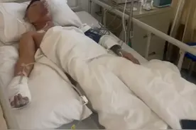 高密一小伙上班6天误触辐射源右手将截肢，入职前未受必要培训图片