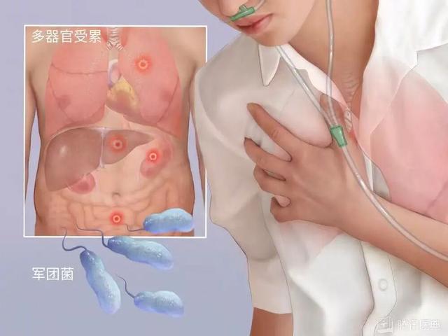 酒店幽灵，一场宴会与34人的死亡