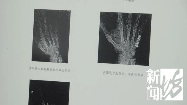 上海外卖员劝架，扑倒持锤行凶者！反被索赔12万？法院判了