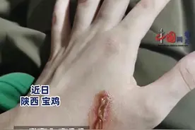 紧急提醒！男子皮肤多处溃烂，只因拍死一只虫子图片
