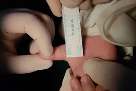 无法伸直手指，日本爹妈“打飞的”带孩子来沪求医图片