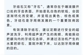 洗牙会让牙齿松动吗？图片