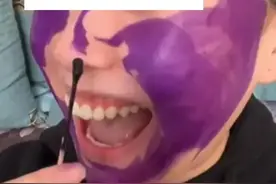 两种“外伤神药”别再用啦！可能引起汞中毒、潜在致癌性图片