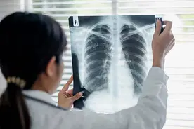 X光、CT、核磁共振，有何不同？“拍片”的辐射到底有多大？|一问医答图片