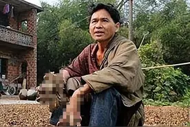 7年前“树人”刘忠文：双手长满树枝，生活无法自理，如今怎么样图片