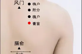 针灸：10种临床疾病的针灸特效方！图片