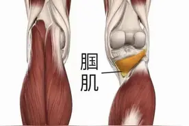 膝盖后面腘窝鼓起大疙瘩？什么情况，骨科医生教给你该怎么办。图片