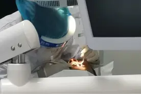 我做根管治疗的真实感受，不要被别人误导了，爽得超乎你的想象图片