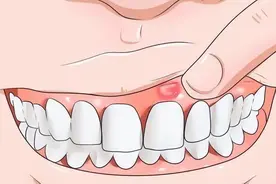 上火、牙疼，用黄连上清片没用？上火也分虚实，一个方子都解决图片