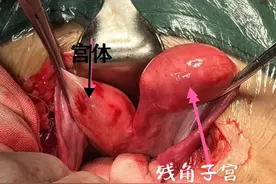 济南市莱芜人民医院：警惕！子宫畸形正在伤害你的好“孕”气图片