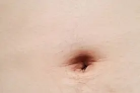 肚脐眼究竟通向哪里？为啥一抠就肚子疼？甚至还会拉肚子？图片
