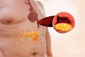 急性肠胃炎必备！这些食物能够帮助你恢复肠胃健康图片