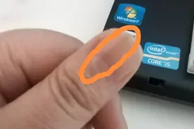 指甲出现黑色竖纹是什么原因导致的图片