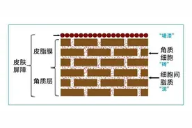 #健康素养提升V计划# 你咋“皮干”的很？我不仅“皮干”还“皮痒”！图片