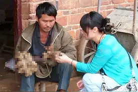 “树人”刘忠文：四肢长满树枝，穿衣吃饭全靠父母，如今他怎样了图片