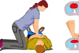 （转发）建议收藏，44种突发情况急救手册图片