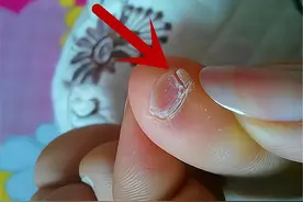 小脚趾指甲分成两瓣的人，到底有什么来头？是纯种汉族的证明吗？图片