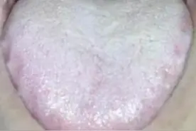 4个男科用药，胜过西地那非，让你肾足底气足，有效起萎不费劲图片