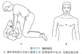 心脏骤停与心脏性猝死一篇盖全图片