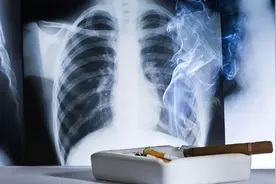 5种香烟已被列入“黑名单”，或许你平时经常抽，不妨自查一下图片