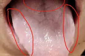 宗筋短缩，战斗时间短，想要加时 增加坚韧度，补肝和补肾缺一不可图片
