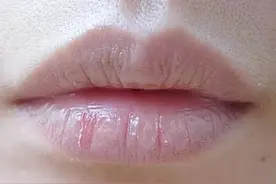 嘴唇干裂、起皮？并不是缺水，而是这个器官对你发出的求救信号！图片