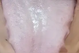 身体有病，舌头先“报警”！3种舌象赶紧调，尤其第3种！图片