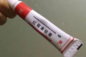 妙！2块钱的红霉素软膏，原来还有这6大用途，建议提早了解图片