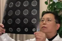 空蝶鞍要紧不？其实大可不必焦虑 #空蝶鞍 #垂体菲薄 #大脑 #医学科普 #医学影像 #大可不必 #我要上热门 视频封面