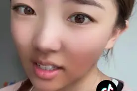 医院诊断已出，社交牛逼症晚期哈哈哈#铁豆有点逗#滑雪