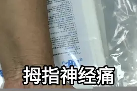 拇指以及大鱼际部分神经痛治疗经验分享