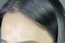 刚打了九价疫苗，给大家分享一下经验#hpv疫苗