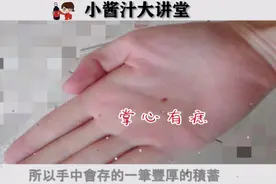 手上长痣代表什么？位置不同运势大不相同，看看你手上的痣视频封面
