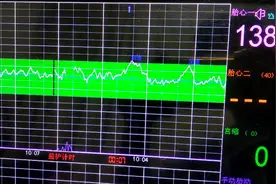 胎心监护仪应该这样看，想当爸妈的要记住
