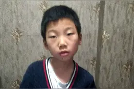 罕见的颈椎，胸椎骨关节严重错位！