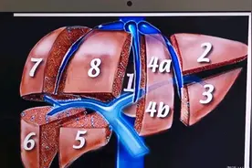 学医的福利，肝脏的分叶分段，先是模拟图后是实例，不信你学不会视频封面