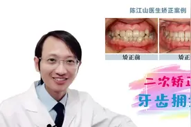 牙齿矫正案例分享视频封面