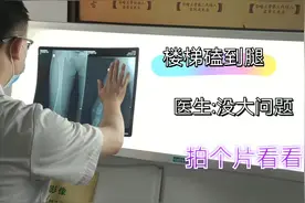 女儿上楼磕到腿，妈妈带医院检查，医生：没大问题，拍片看看？视频封面