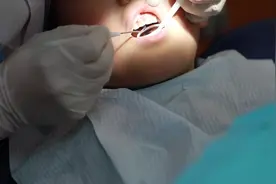 儿童拔牙的全过程，小朋友：还没反应过来就拔完了！