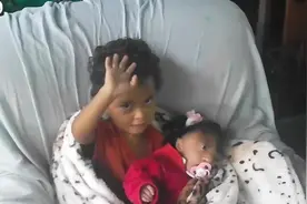 先天性无脑症宝宝有个这样的哥哥，让人很暖心！来看看吧