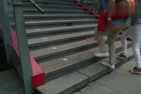 大妈摔折了腿，听到要动手术后，吓得脸色都变了视频封面