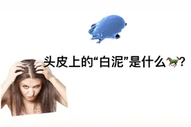 头皮上抠下的“白泥”是什么？别再当成头皮屑了，答案没那么简单