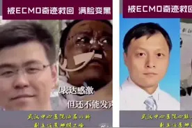 落泪致敬！武汉2位医生被救回后脸色发黑，专家：器官受损可恢复视频封面