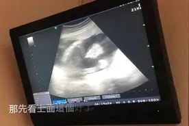 孕19周2天产检做B超过程实录，双胞胎宝宝齐头并进发育良好！视频封面