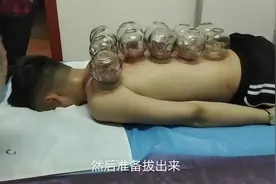 小伙今天去拔火罐，拔完后背皮肤紫黑暗红，医生说是湿气重要调理