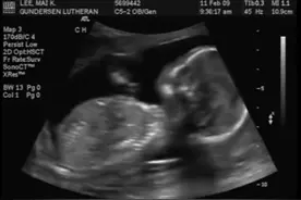 怀孕18周左右的胎宝宝超声检查视频