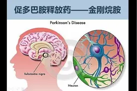 17促多巴胺释放药——金刚烷胺视频封面