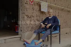 祖传手艺修脚治鸡眼，把死皮一片片切下来，爸爸舒服都快睡着了。视频封面